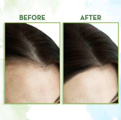Mamaearth Rosemary Hair Growth Oil with Rosemary & Methi Dana - 150 ml