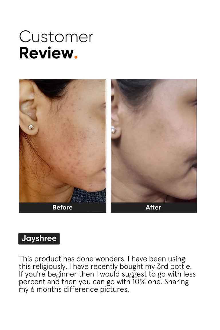 Minimalist 10% Niacinamide Face Serum - 30 ml