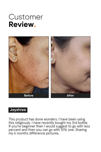 Minimalist 10% Niacinamide Face Serum - 30 ml