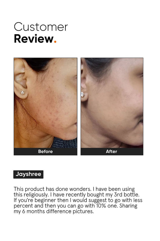 Minimalist 10% Niacinamide Face Serum - 30 ml