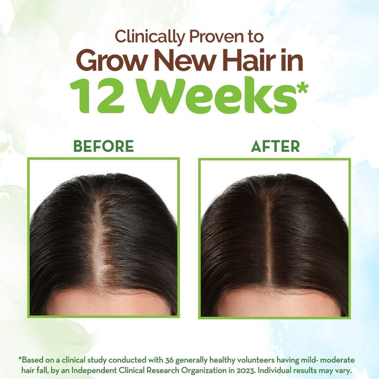 Mamaearth Rosemary Hair Growth Oil with Rosemary & Methi Dana - 150 ml