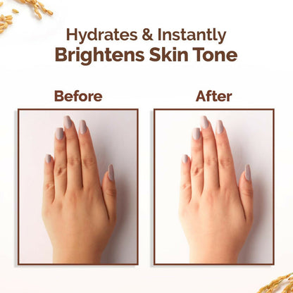Mamaearth Rice Water Tone Up Face Cream with Rice Water & Niacinamide for Glass Skin - 50 gm