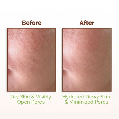 Mamaearth Rice Water Dewy Face Toner with 96% Pure Rice Water Extract & 4% Niacinamide for Glass Skin - 150 ml